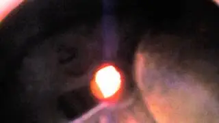 MVI 2451
