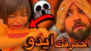 احترقت ايدو 😱😭ياريت ماصورنا هالفيديو😩💔