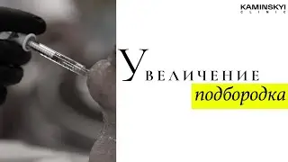 Современная косметология. Увеличение подбородка под контролем УЗИ 