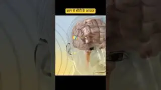 कान से सीटी की आवाज़ - ear ringing cause