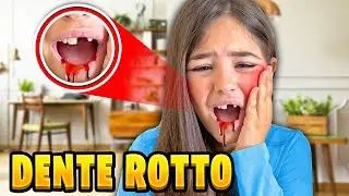 GIULIA SI È ROTTA IL DENTE E SI FA MALE E ESCE TANTO SANGUE E FINISCE IN OSPEDALE!