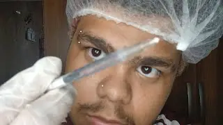 ASMR APLICANDO BOTOX EM VOCÊ