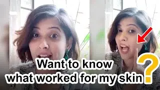 SkinKraft Review by Sheeki - A Customized  Solution For All Skin Problems