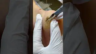 ЧТОБЫ НЕ МЕШАЛА ТРЕЩИНА #аленалаврентьева #shortsvideo #кусачки #nipponnippers #трещина #подолог