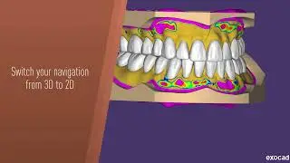 Exocad x 3Dconnexion - SpaceMouse benefits and features