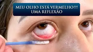 MEU OLHO ESTÁ VERMELHO!!! UMA REFLEXÃO