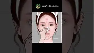 Pimple Popping丨Blackheads Removal丨ASMR Skin Care Animation!丨Meng's Stop Motion