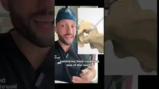 Tiger woods had this surgery. #golf #spine #medical #medtok #tigerwoods