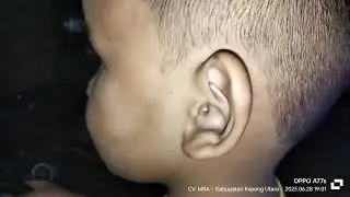lanjut par 2