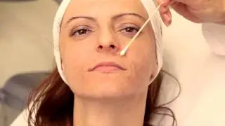 Dr. Tchelebi demonstrates a session of FotoFacial - IPL
