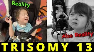 The Reality of Being a Trisomy Parent (TRISOMY 13 / PATAU SYNDROME)