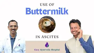 Buttermilk in Ascites Management| Ascites Ayurveda Treatment| Buttermilk uses