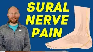 Sural Nerve Pain | Diagnosis, Treatment and Sural Nerve Glider Exercises