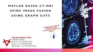 OPEN SOURCE CODE-MATLAB BASED CT MRI SPINE IMAGE FUSION USING GRAPH CUTS