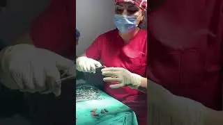 Vagınoplastıka+labıoplastıka+polıpektomiya  əməliyyatları