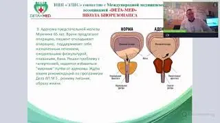 Аденома предстательной железы 2022.01.19