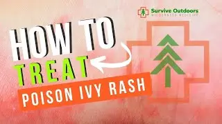 How to Treat Poison Ivy Rash