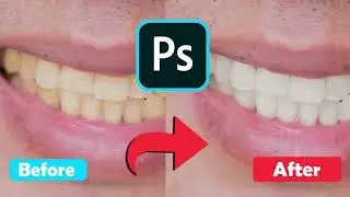 How To Yellow Teeth Color Change In Photoshop | How to make yellow teeth white in photoshop?