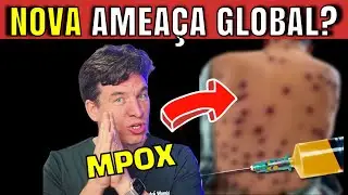 NOVA EMERGÊNCIA DE SAÚDE GLOBAL? - MPOX