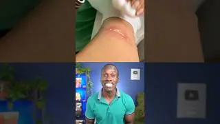 Should you use hydrogen peroxide on wounds? Truth or Trash ep. 42 