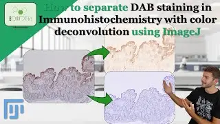 How to separate DAB staining in a IHC with color Deconvolution using ImageJ 