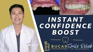 Instant Confidence Boost: Smile Design & 3D Printed Bridge!