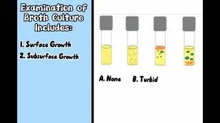 Characterization of Bacterial Culture in Nutrient Broth