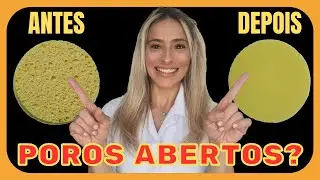 Poros Abertos e Cravinhos no Nariz? Veja o MELHOR TRATAMENTO da Atualidade!