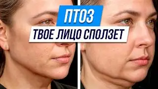 Главный признак СТАРЕНИЯ! Как предотвратить и УСТРАНИТЬ птоз лица?