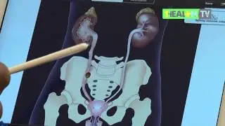 Batu Saluran Kemih - Dr. dr.  Nur Rasyid, Sp. K