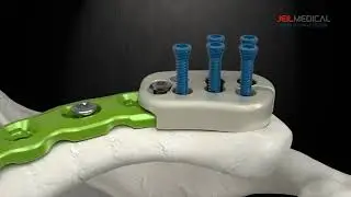 [ARIX OS] ARIX Clavicle Surgical Guide