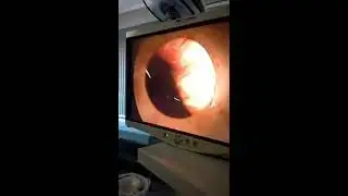 1514288089179475