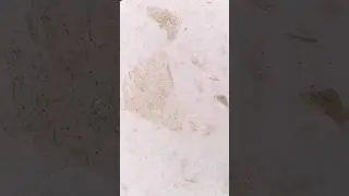 White Blood Cells under the microscope 