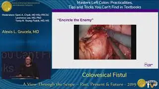 Colovesical Fistul