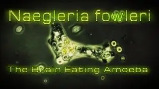 Naegleria fowleri - The Brain Eating Amoeba