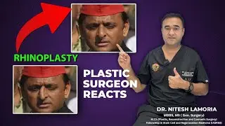 Rhinoplasty suggested for Akhilesh Yadav
