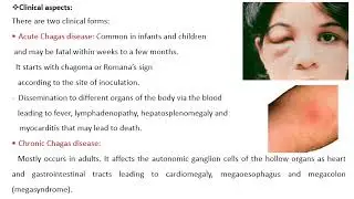 trypanosoma 2