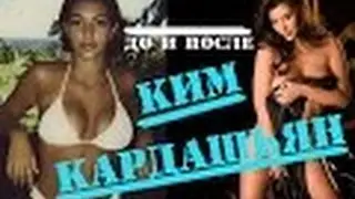 Ким Кардашьян  Ким Кардашьян от 1 до 36 лет  Ким Кардашьян до и после  Часть 2  #Кардашьян #Ким