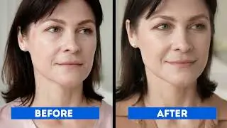 Dark Spots On Face Removal