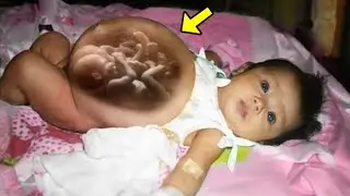 The doctors almost lost consciousness! Newborn Girl was born pregnant!