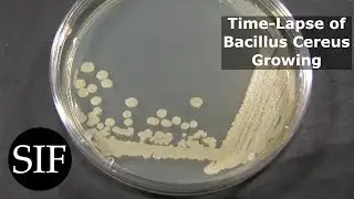 Time Lapse of Bacteria - Bacillus Cereus - Growing in Petri Dish