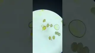 Your Allergies (Pollen) Under Microscope 