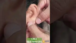Ear Pasting lotion/ Ear Repair /Earlobe / Torn Ear lobe Repaired Earlobe -9687889595 #earholerepair