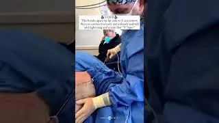 GLADIATOR LIPO MUSCLE ETCHING | Dr. Jason Emer