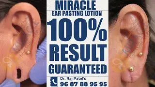 बिना ऑपरेशन, बिना टांके - सिर्फ 10 सेकंड में कान का बड़ा छेद करें छोटा | How To Reduce Ear Hole Size