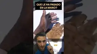 Que le ha pasado en la mano?. 