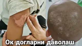 OQ DOG'LARNI DAVOSI TOPILDI ОК ДОГЛАРНИ ДАВОЛАШ