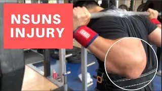 NSUNS 531 Why I Stopped Running The Program | Elbow Tendonitis & Injury Prone