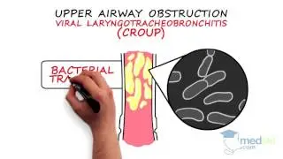 Pediatrics – Pediatric Respiratory Distress: By Quynh Doan M.D.