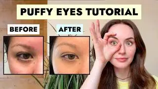 What To Do Against Puffy Eyes